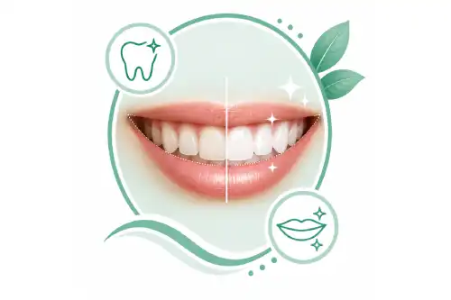 Smile Designing